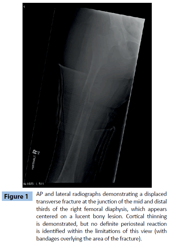 archivesofmedicine-lateral-radiographs