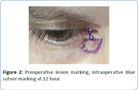 archivesofmedicine-lesion-marking