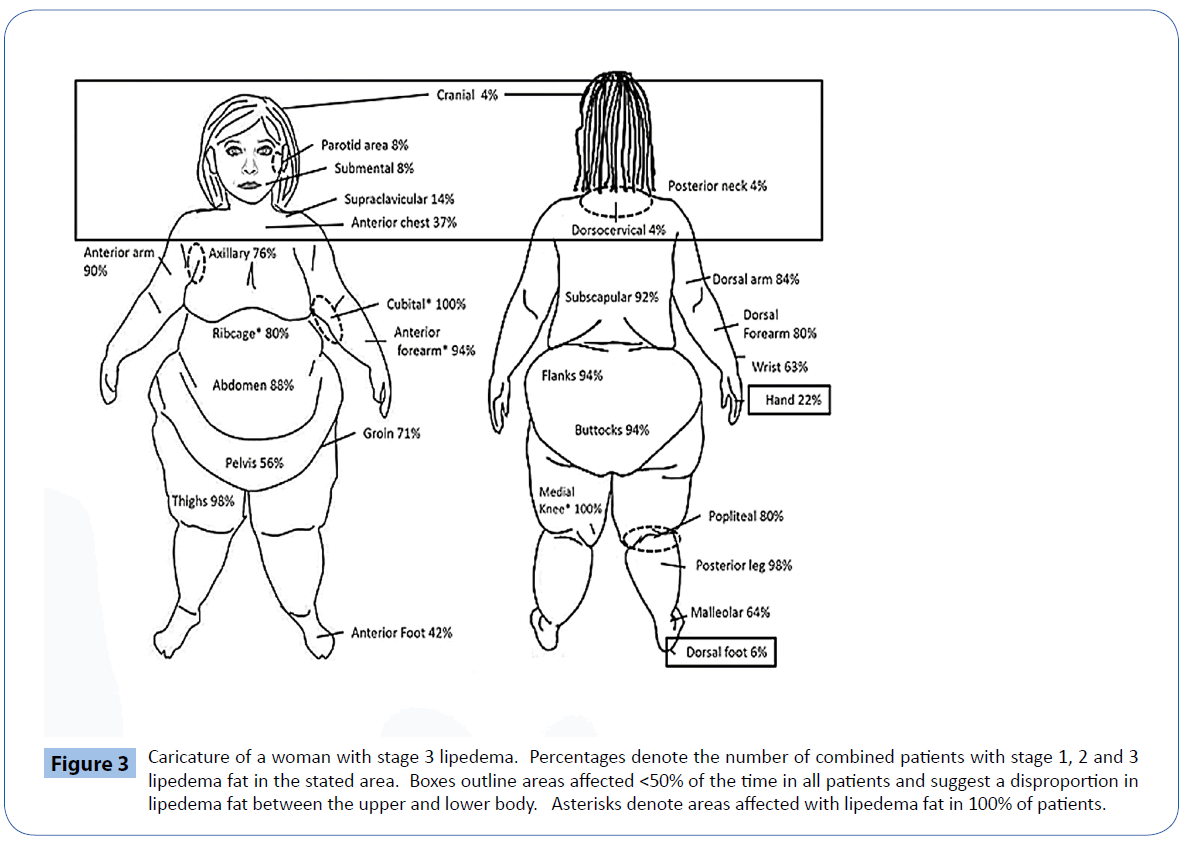 archivesofmedicine-lipedema-fat