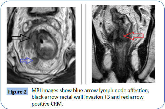 archivesofmedicine-lymph-node