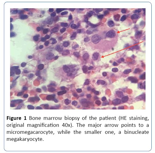 archivesofmedicine-marrow-biopsy