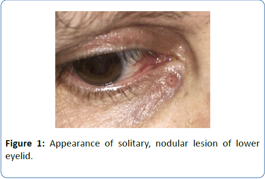 archivesofmedicine-nodular-lesion