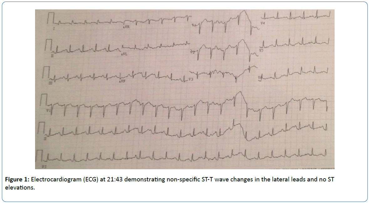 archivesofmedicine-non-specific-ST-T