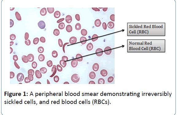 archivesofmedicine-red-blood