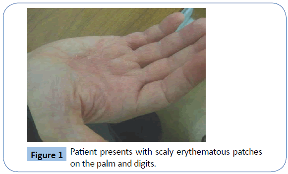 archivesofmedicine-scaly-erythematous-patches