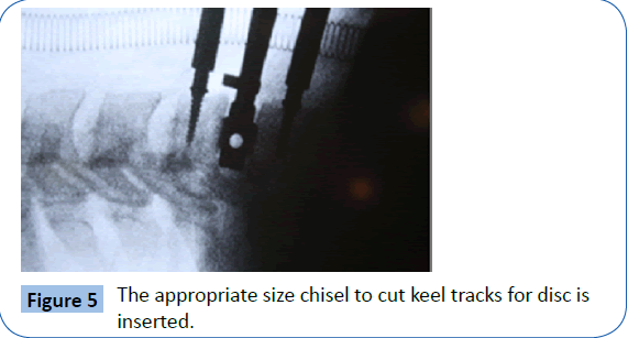 archivesofmedicine-size-chisel