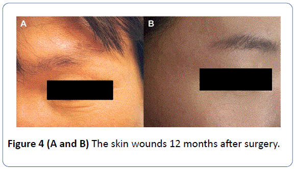 archivesofmedicine-skin-wounds-12-months