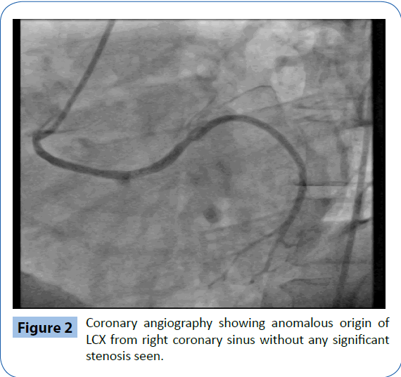 archivesofmedicine-stenosis-seen