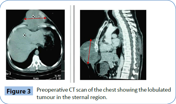 archivesofmedicine-sternal-region