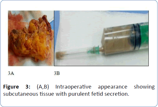 archivesofmedicine-subcutaneous-tissue