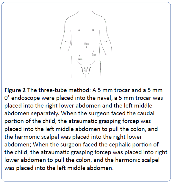 archivesofmedicine-three-tube-method