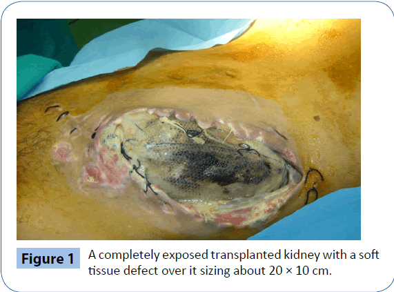 archivesofmedicine-tissue-defect