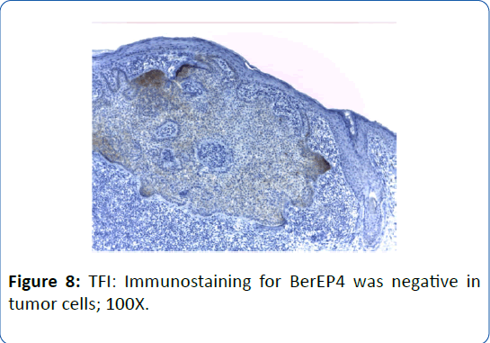 archivesofmedicine-tumor-cells