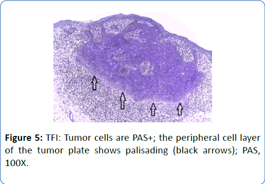 archivesofmedicine-tumor-plate