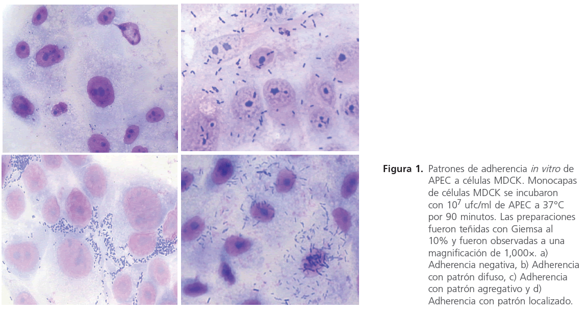 archivosdemedicina-Adherencia-negativa