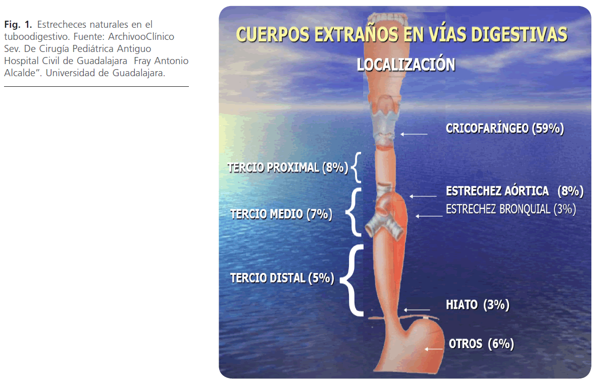 archivosdemedicina-Estrecheces-naturales