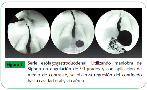 archivosdemedicina-Utilizando-maniobra