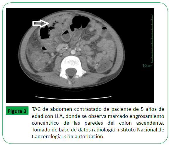 archivosdemedicina-abdomen-contrastado