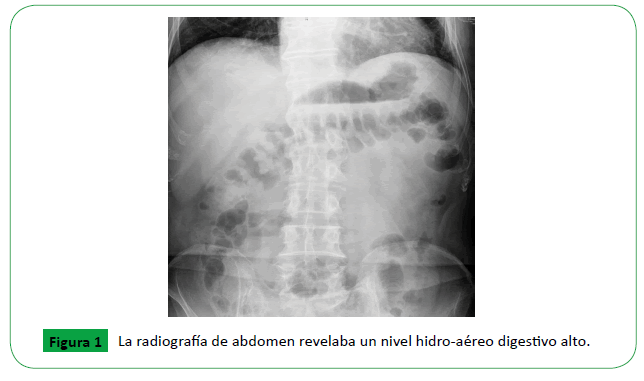 archivosdemedicina-abdomen-revelaba