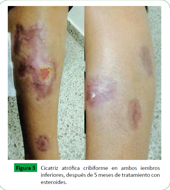 archivosdemedicina-ambos-iembros