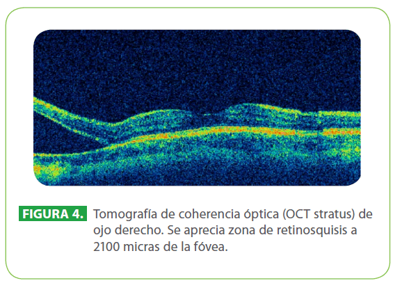 archivosdemedicina-aprecia-zona