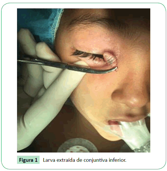 archivosdemedicina-conjuntiva-inferior