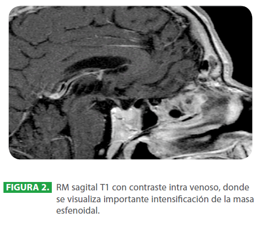 archivosdemedicina-contraste-intra