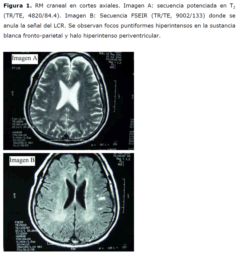 archivosdemedicina-cortes-axiales