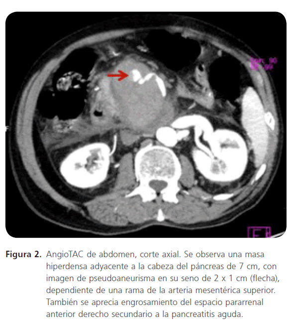 archivosdemedicina-de-abdomen