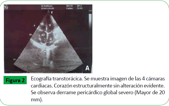 archivosdemedicina-global-severo