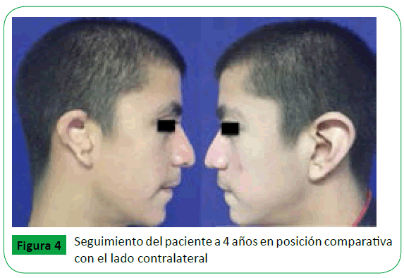 archivosdemedicina-lado-contralateral