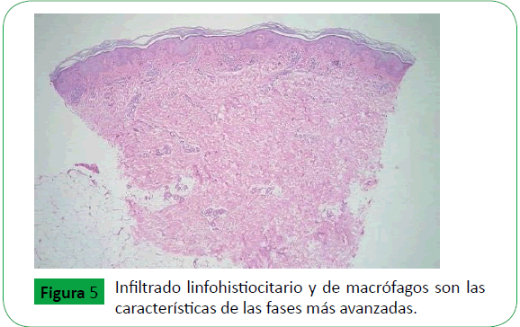 Dermatitis Cenicienta