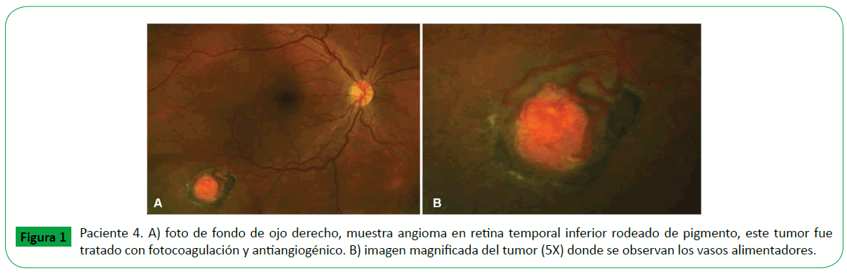 archivosdemedicina-magnificada-del-tumor