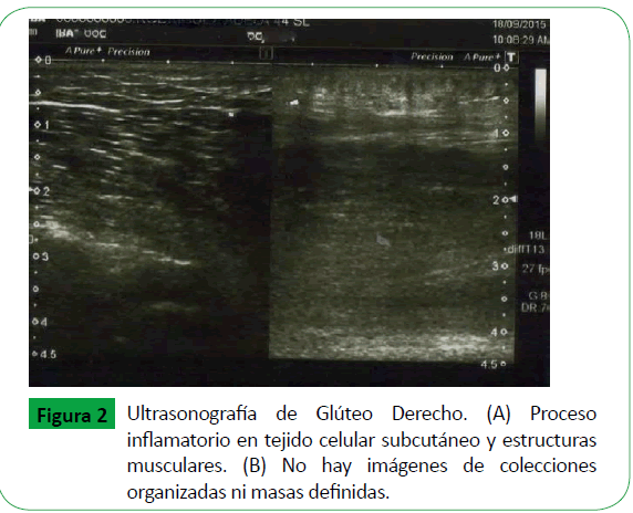 archivosdemedicina-masas-definidas