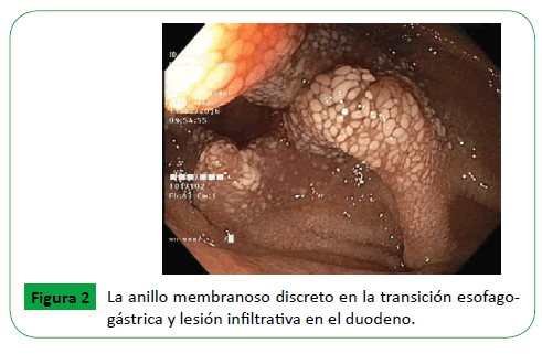 archivosdemedicina-membranoso-discreto