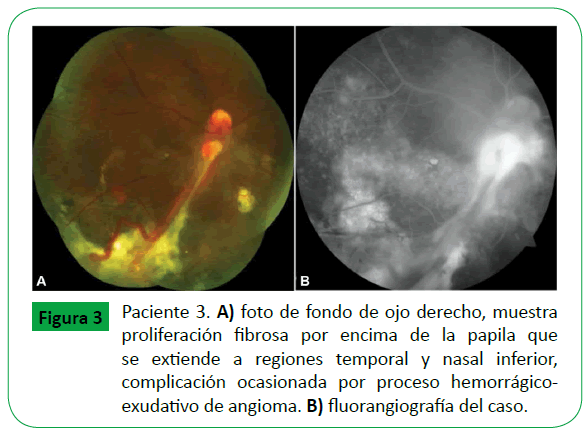 archivosdemedicina-ocasionada-por-proceso