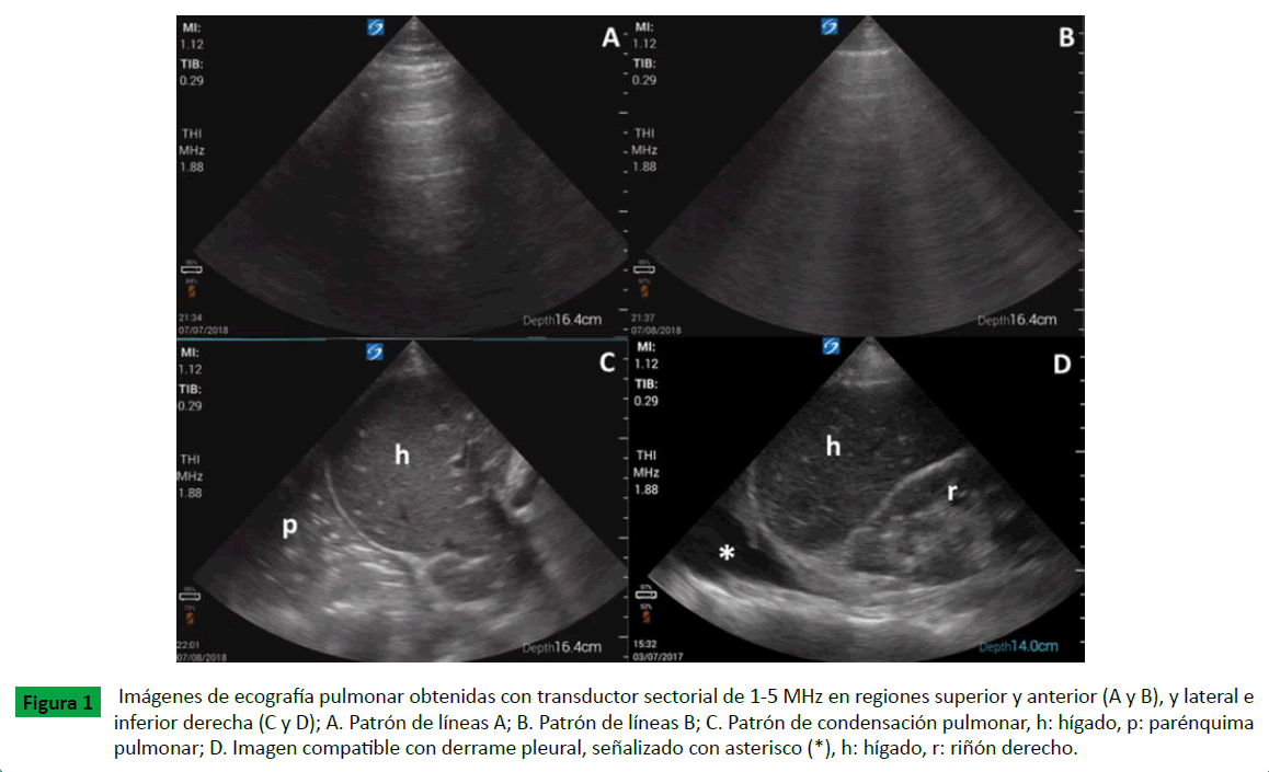 archivosdemedicina-pulmonar-obtenidas