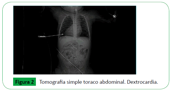 archivosdemedicina-simple-toraco