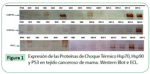 archivosdemedicina-tejido-canceroso