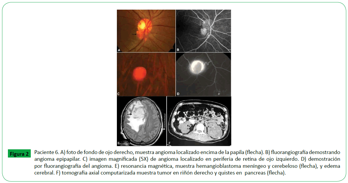 archivosdemedicina-tomografia-axial-computarizada