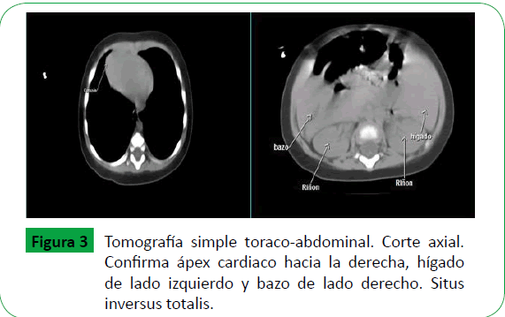 archivosdemedicina-toraco-abdominal