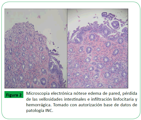 archivosdemedicina-vellosidades-intestinales