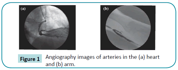 biomedical-sciences-Angiography-images