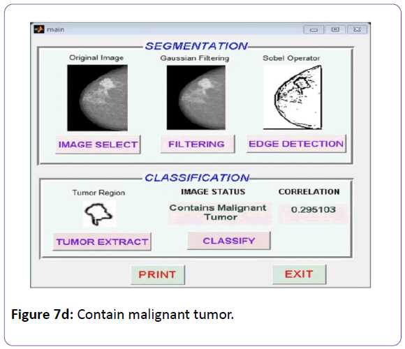 biomedical-sciences-Contain-malignant-tumor