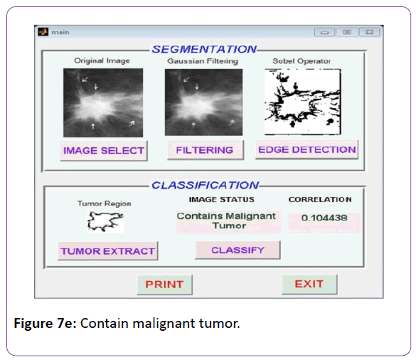 biomedical-sciences-Contain-malignant-tumor