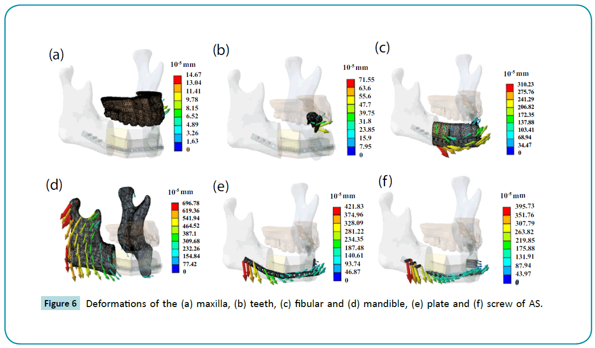 biomedical-sciences-Deformations-maxilla