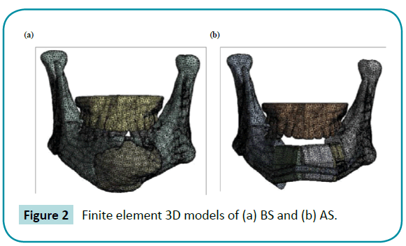 biomedical-sciences-Finite-element