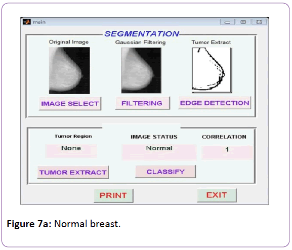 biomedical-sciences-Normal-breast