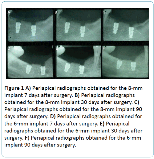 biomedical-sciences-Periapical-radiographs