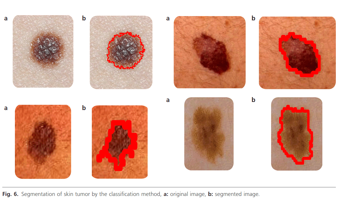 biomedical-sciences-Segmentation-skin